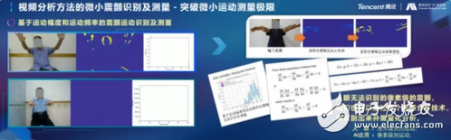 腾讯医疗人工智能不断探索 推动医学解决盲点